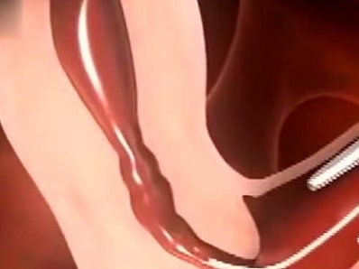 广州做第三代试管助孕的医院有哪些(哪些人适合做试管助孕)