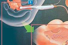 上海市东方医院做试管婴儿贵吗？上海市东方医院做试管需要花多少钱？