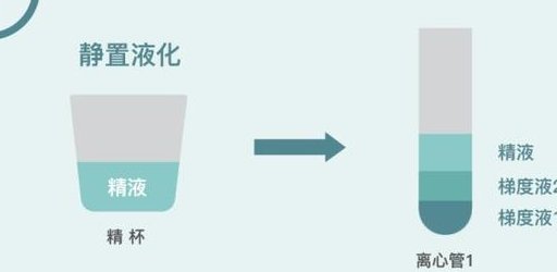 在浙江省做试管婴儿长方案周期需要多久？超长方案促排流程是怎么样的？